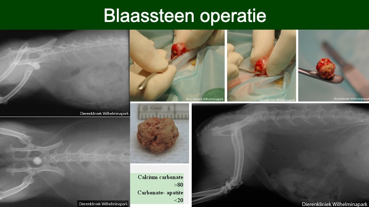 Blaassteen verwijderen met een operatie